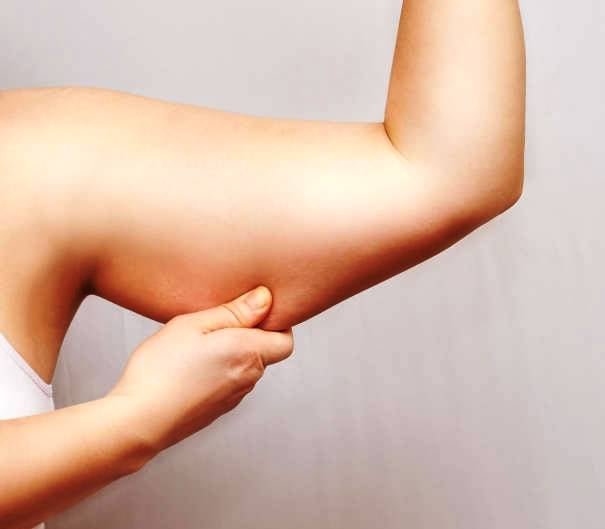 How To Get Rid Of flabby Arms